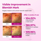 [Dr.Melaxin Exclusive] 4-Piece Skincare Set